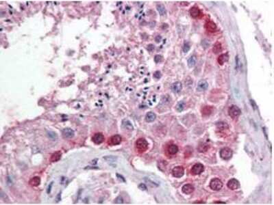 Immunohistochemistry: Cullin 4a Antibody - N-terminal [NBP1-78040]